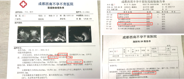 开云官方网站：西南医院赵成元：两次促卵后让差点抑郁的她嚎啕大哭！(图2)